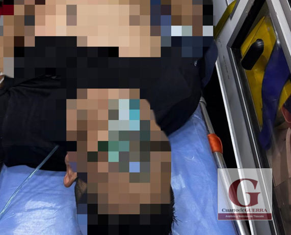 Balean a hombre para robarle motocicleta en Yauhquemehcan